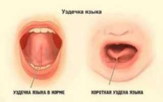 Болит под языком больно глотать