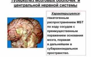 Туберкулез головного мозга симптомы