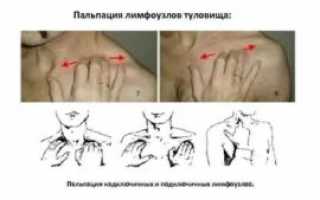 Подключичные лимфоузлы расположение