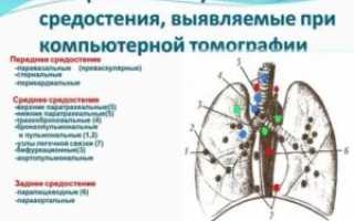 Лимфоузлы средостения где находятся
