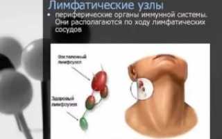 Периферические лимфоузлы где находятся