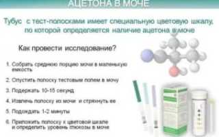 Повышенный ацетон в крови