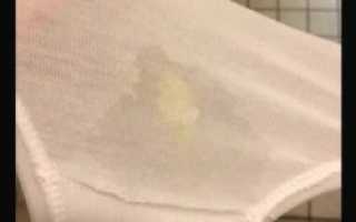 Обильные водянистые выделения у женщин как вода