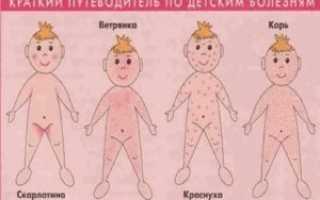 Может ли взрослый заразиться скарлатиной от ребенка