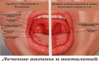 Красные миндалины фото