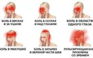 Боль в области скулы на лице