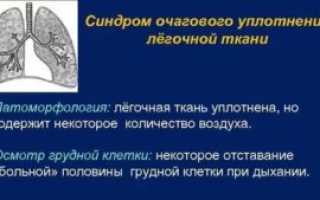 Очаговое уплотнение легочной ткани