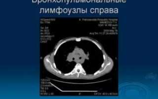 Бронхопульмональные лимфоузлы