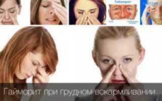Гайморит при лактации чем лечить